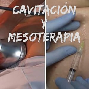 Lee más sobre el artículo Cavitación y mesoterapia